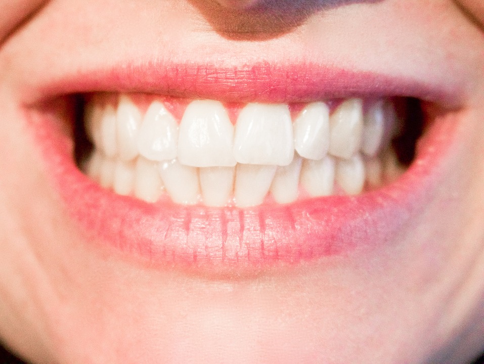 Healthy teeth and gums - Mississauga Dentist - Bristol Dental