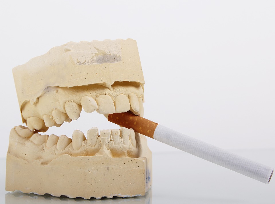 A teeth model biting a cigarette - Mississauga Dentist - Bristol Dental