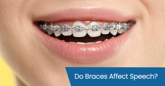 Do braces affect speech?